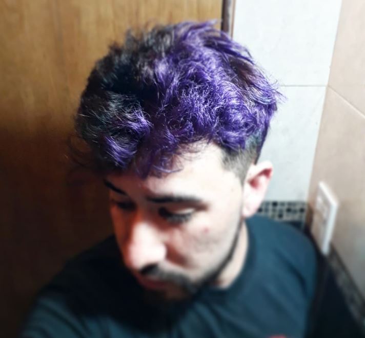 skinrrex4